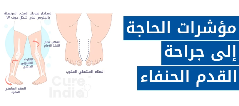 دواعي إجراء جراحة القدم الحنفاء